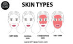 SKIN TYPES