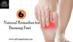 6 Natural Remedies For Burning Feet
