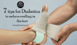 7 tips for diabetics to reduce swelling in the feet